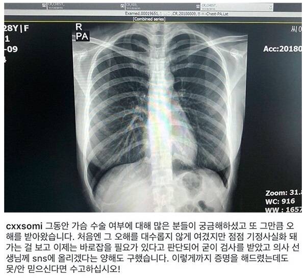 먹튀검증 참가슴_인증_그녀 안전토토사이트